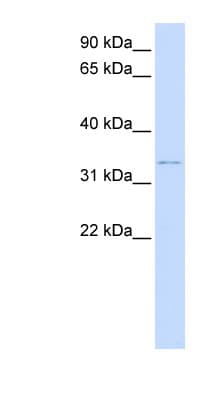 DCN / Decorin Antibody (aa36-85)