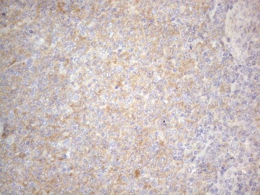 PRMT5 Antibody (aa238-499, clone OTI2H3)