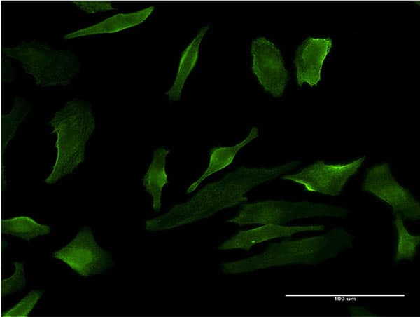 P2RY1 / P2Y1 Antibody (clone 4C2)