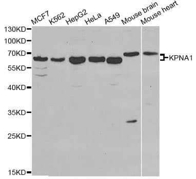 KPNA1 / Importin Alpha 5 Antibody