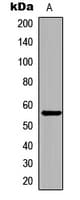 CHEK1 / CHK1 Antibody (phospho-Ser296)