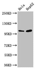 Polyclonal Rabbit anti-Human CTNNA1 / Catenin Alpha-1 Antibody (WB)