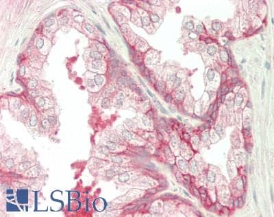 IHC-plus™ CAPN1 / Calpain 1 Antibody