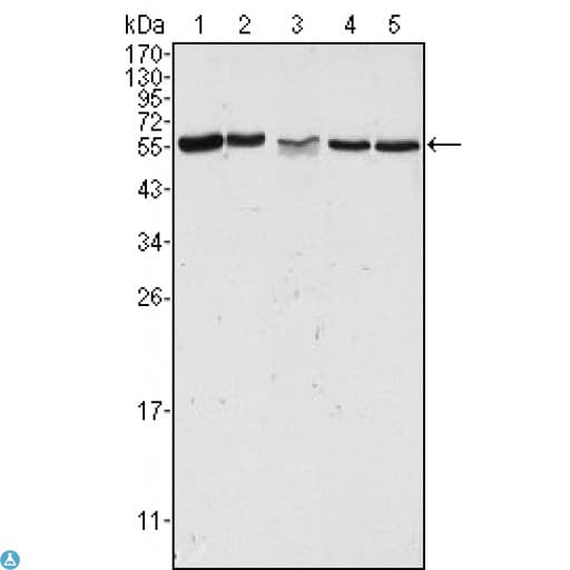 Monoclonal Mouse anti-Human PAK2 Antibody (IHC, IF, WB)