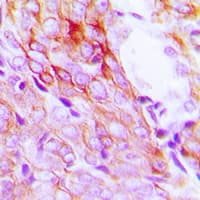 IHC-plus™ Polyclonal Rabbit anti-Human EGFR Antibody (C-Terminus, IHC, IF, WB)