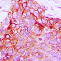 ADGRF5 / GPR116 Antibody (C-Terminus)