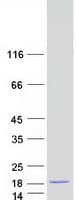 Human HIST2H2AB Protein (Recombinant Myc-DDK (Flag))