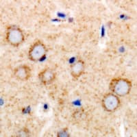 TGFBR2 Antibody (Internal)