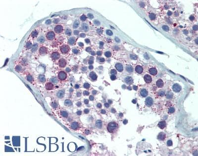 IHC-plus™ MAC-2-BP / LGALS3BP Antibody (clone 1C2)