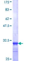 Human SLC13A5 Protein (Recombinant GST, N-terminus)