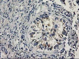 PNMT Antibody (clone OTI2E3)