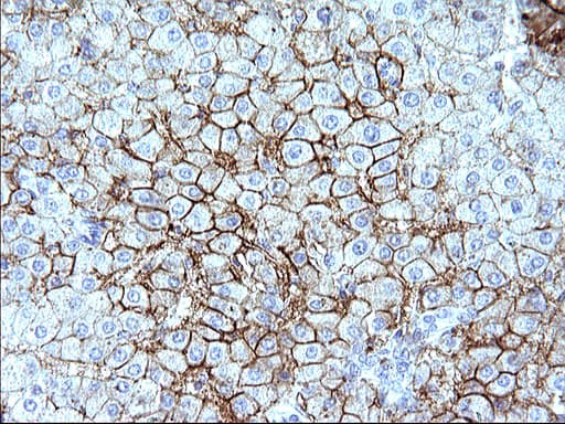 SCARB1 / SR-BI Antibody (clone OTI1G4)