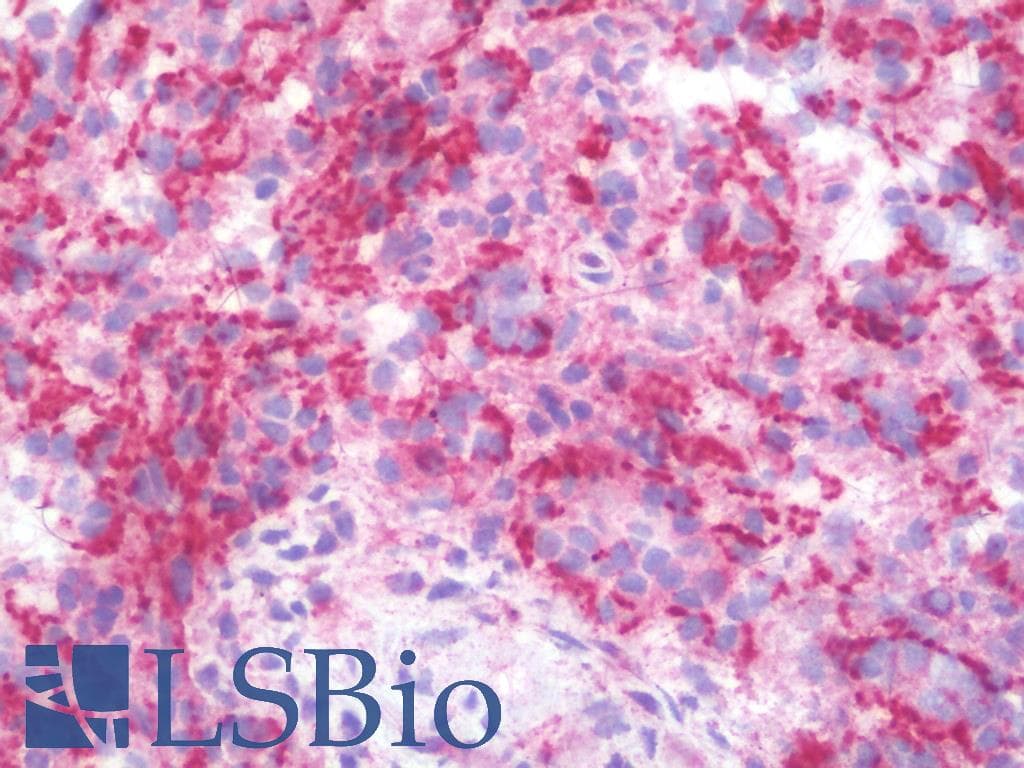 IHC-plus™ Monoclonal Mouse anti-Human MAP3K11 / MLK3 Antibody (clone 3D11, IHC, WB)