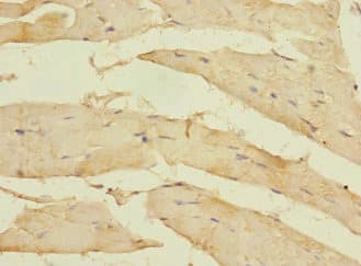 KIAA1161 Antibody