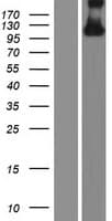 HYDIN Protein (Over-Expression Lysate Myc-DDK (Flag))