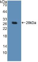 DDB2 Antibody (aa166-383, APC)