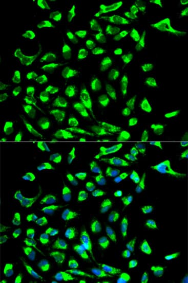 Polyclonal Rabbit anti-Human CLDN7 / Claudin 7 Antibody (IHC, IF, WB)