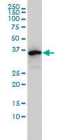 IHC-plus™ Monoclonal Mouse anti-Human EIF2B2 Antibody (clone 5B12-E10, IHC, WB)