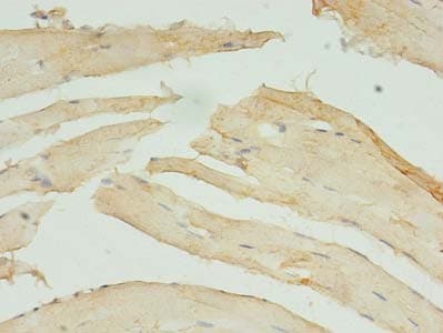 STX10 / Syntaxin 10 Antibody