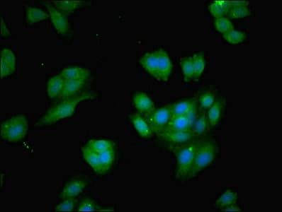 BCAT1 / ECA39 Antibody