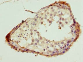 NLK Antibody