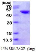 Human CTH / Cystathionase Protein (Recombinant His)