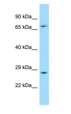 TFPT / Amida Antibody (aa129-178)