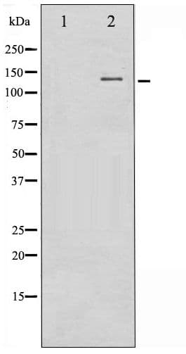 Polyclonal Rabbit anti-Human FGFR1 / FGF Receptor 1 Antibody (phospho-Tyr654, IF, WB)
