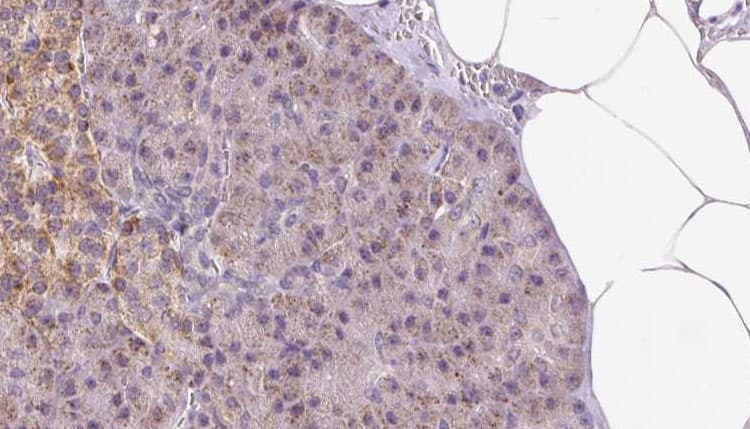 PDIA6 / ERP5 Antibody