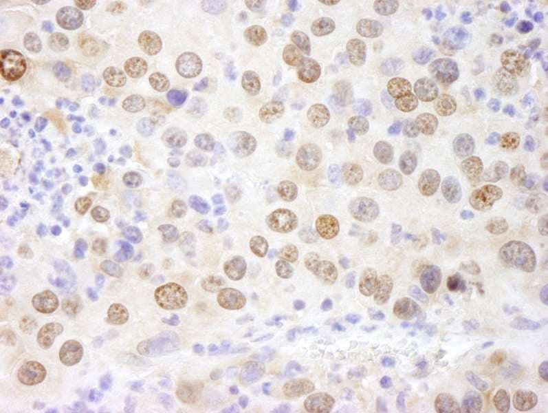 Polyclonal Rabbit anti-Human HMGN1 / HMG14 Antibody (aa90-100, IHC, IF)