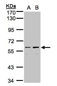 CCDC102B Antibody (aa244-513)