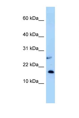 NUDT15 Antibody (aa33-82)