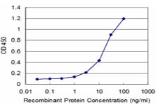 PathPlus™ CANX / Calnexin Antibody (clone 1D4)