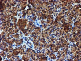 IDS / Iduronate 2 Sulfatase Antibody (clone OTI1D9)