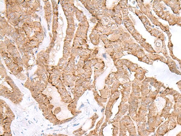MAGOHB / Mago Antibody