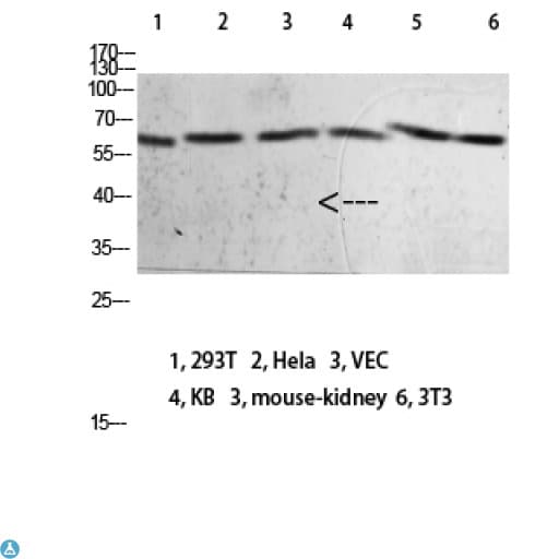 Polyclonal Rabbit anti-Human NOX1 Antibody (IHC, WB)