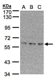EPM2AIP1 Antibody (aa1-43)