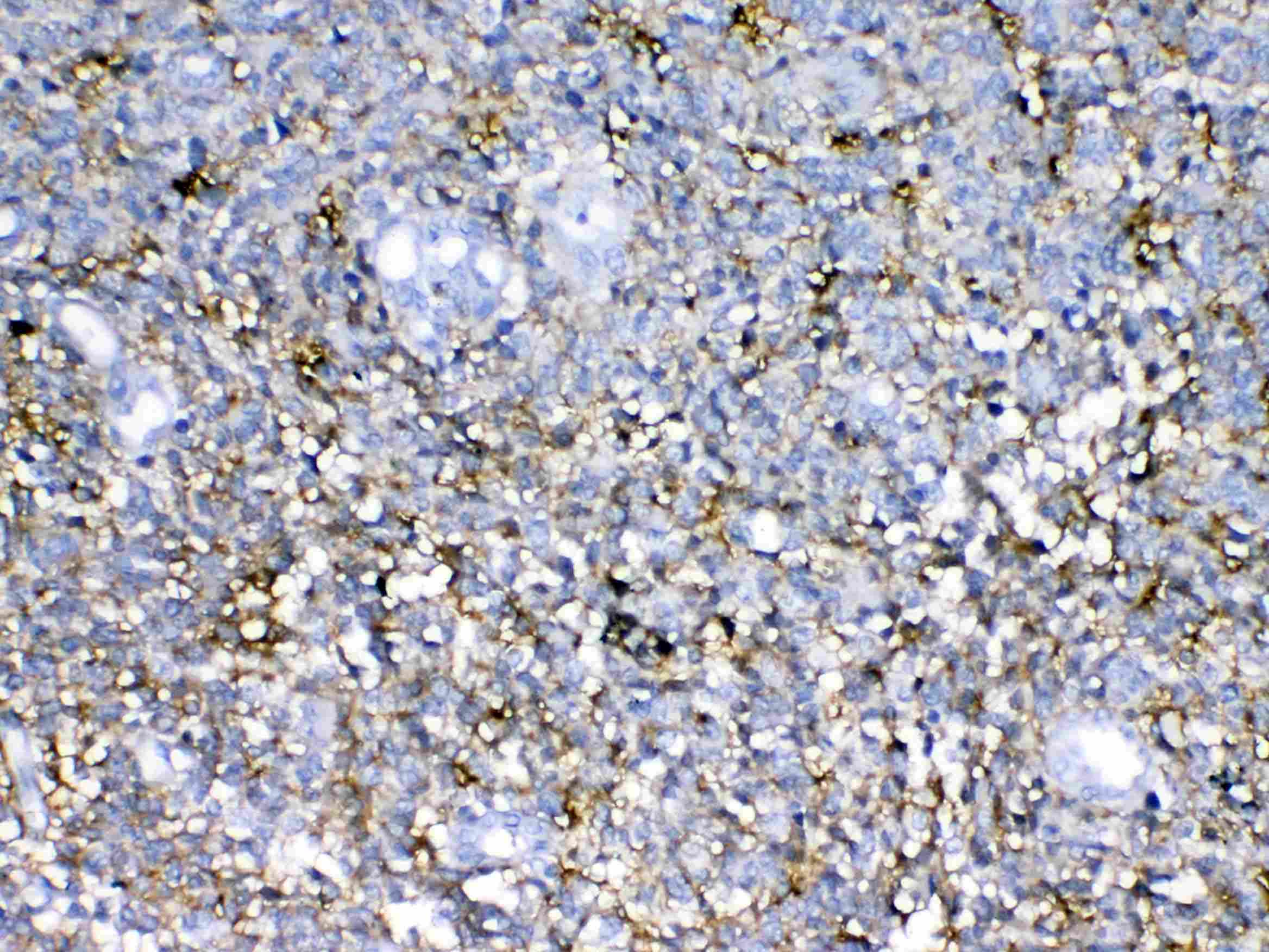 NCAN / Neurocan Antibody