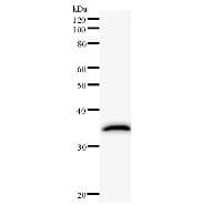 TRIOBP Antibody (clone 2438C1a)