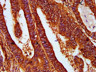 Polyclonal Rabbit anti-Human REG4 / REG-IV Antibody (IHC)