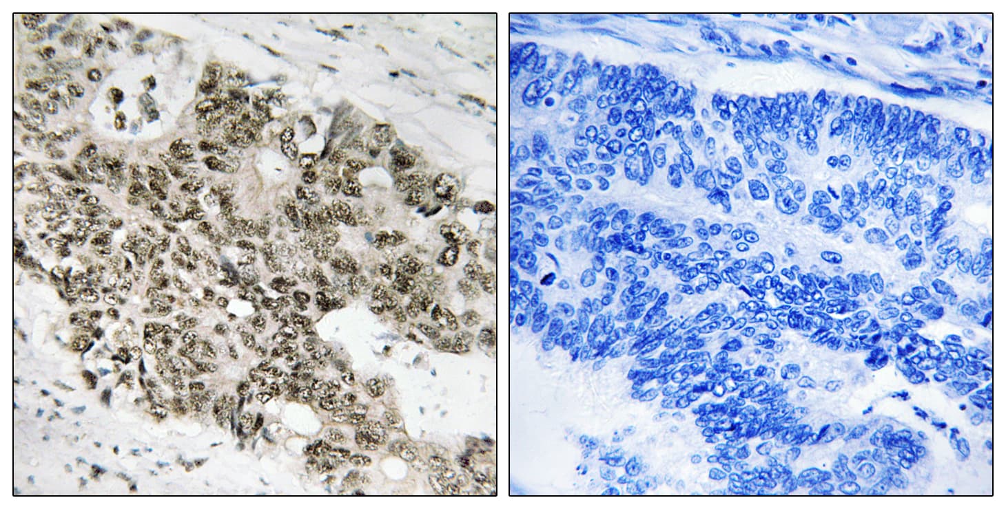 ATR Antibody (aa394-443)