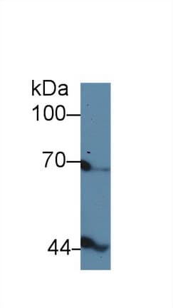 INHBB / Inhibin Beta B Antibody (aa277-391)