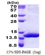 Human XTP4 / C17orf37 Protein (Recombinant His)