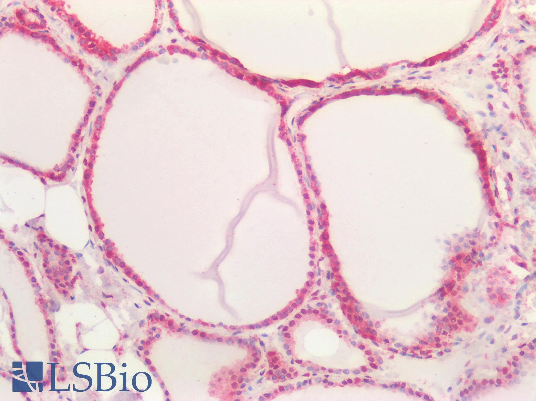 PathPlus™ P4HA1 Antibody (clone 4F1)