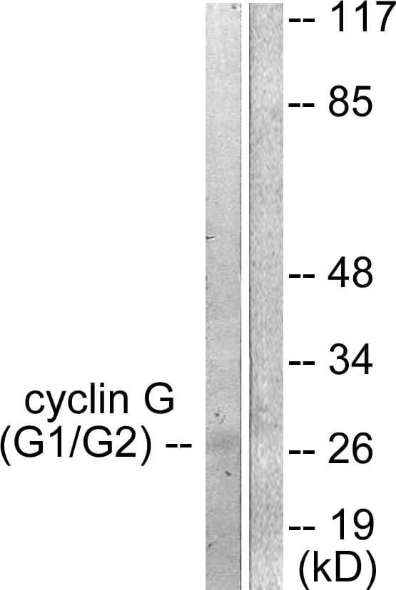 Polyclonal Rabbit anti-Human CCNG1 / Cyclin G1 Antibody (aa161-210, IHC, WB)