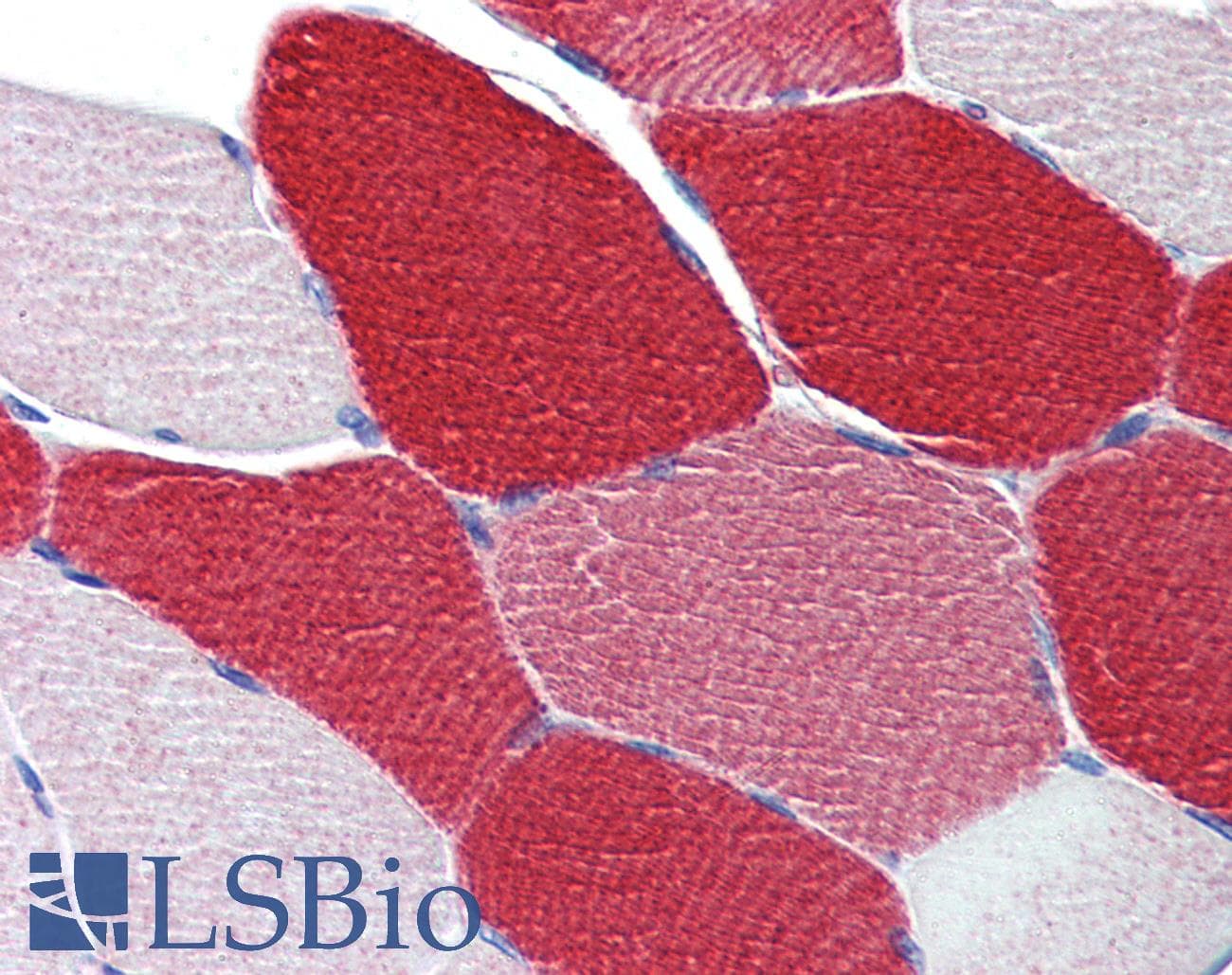 MYL6 Antibody (aa72-121)