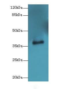 Polyclonal Rabbit anti-Human ERLIN1 / SPFH1 Antibody (IHC, WB)