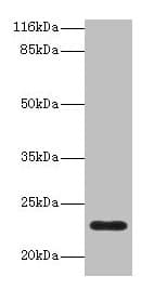 Polyclonal Rabbit anti-Human Complement C8g Antibody (aa21-202, WB)