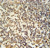 Polyclonal Rabbit anti-Human MAML3 / CAGH3 Antibody (aa640-665, IHC, WB)
