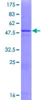 Human PRELID1 Protein (Recombinant GST)